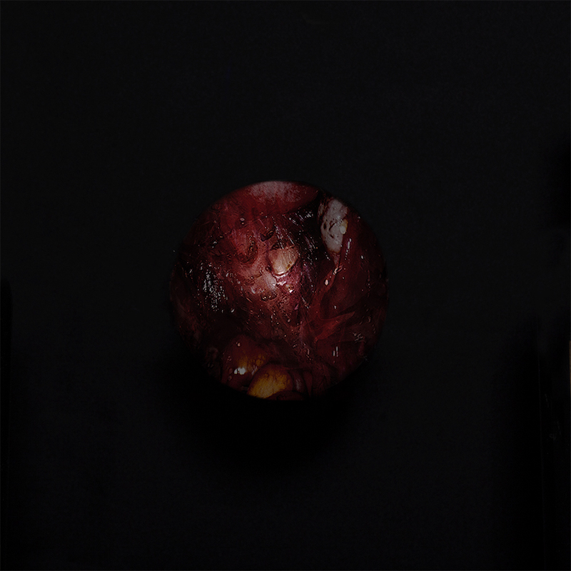 LauraBerson-Le mythe d'endomètre-10