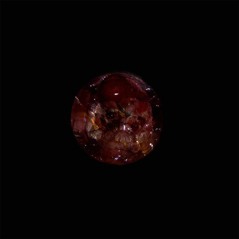 LauraBerson-Le mythe d'endomètre-12