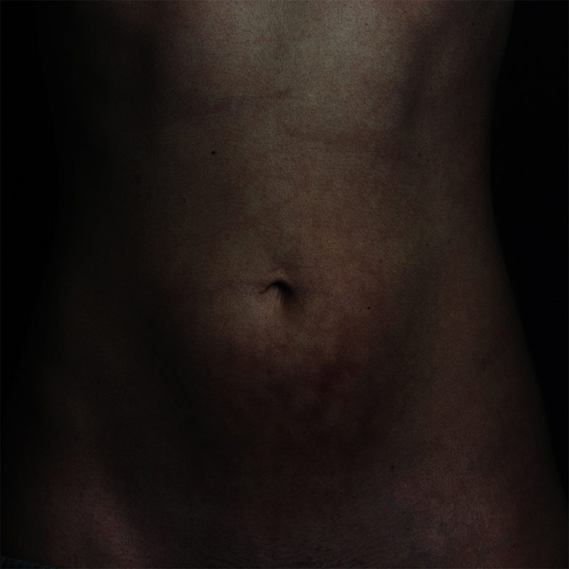 LauraBerson-Le mythe d'endomètre-4